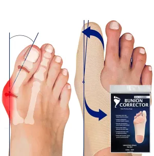 Bunion Corrector for Women Big Toe Straightener. Ultra-Thin Corrective Socks for Inside Any Shoe. Flexible Brace for Hallux Valgus Relief. Day & Night Splint for Crooked & Overlapping Toes (Med-Left)